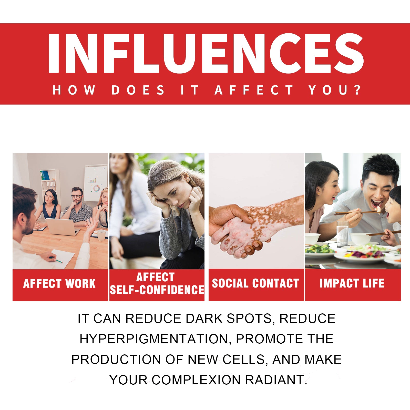 Dark Spot Whitening Cream, Lightening Yellow Brown White Spot Cream Dark Spots Correct Skin Tone Moisturize Skin Whitening